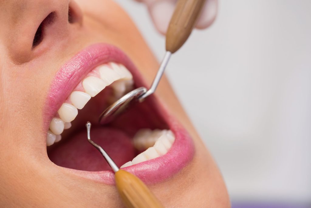 Paciente em avaliação odontológica com espelho e sonda, durante check-up preventivo na Sorridents Porto Alegre.