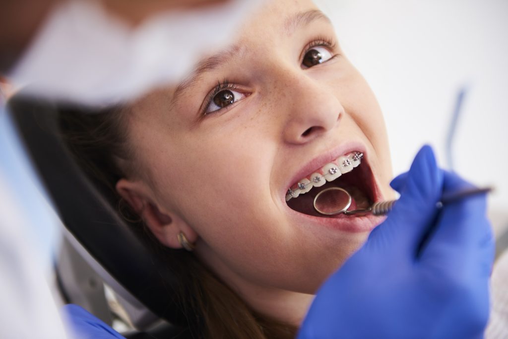 Menina realizando avaliação ortodôntica com aparelho fixo em clínica odontológica em Porto Alegre.