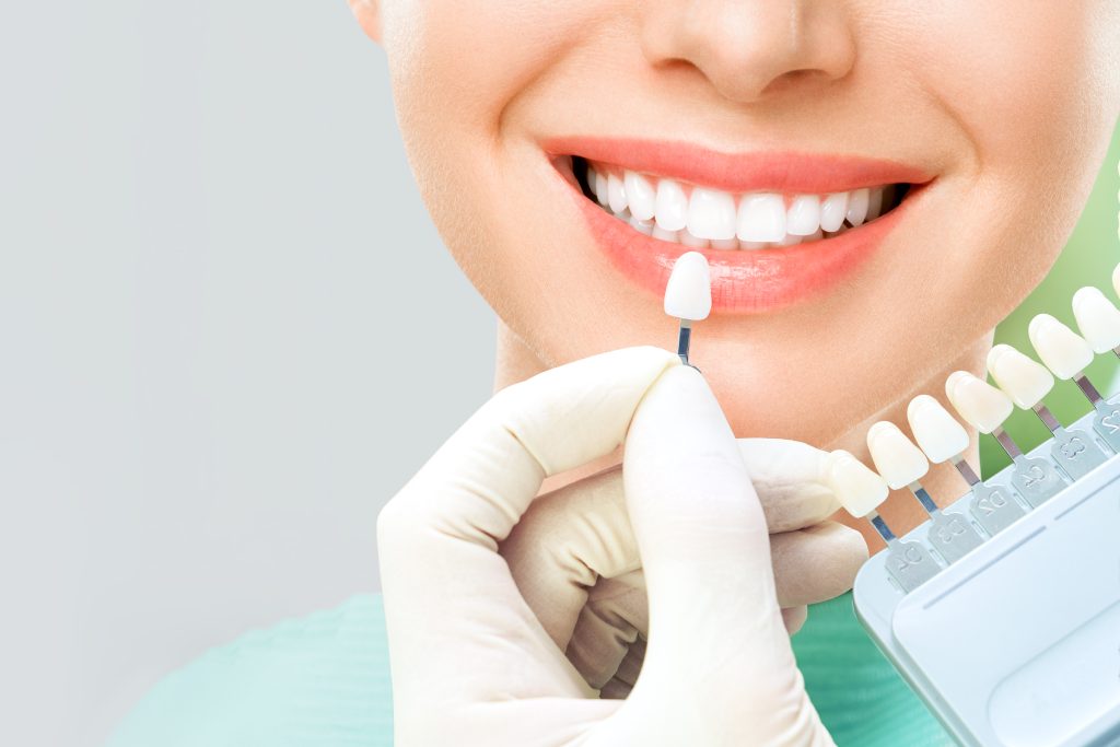 Profissional compara faceta dental com os dentes da paciente durante tratamento estético na Sorridents Porto Alegre.