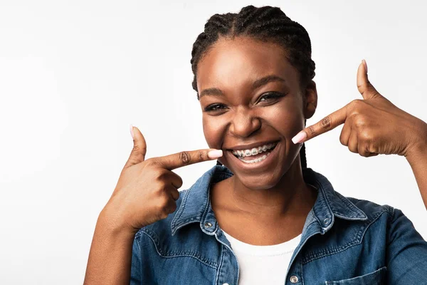 Foto de um jovem sorrindo, mostrando o aparelho ortodôntico com orgulho